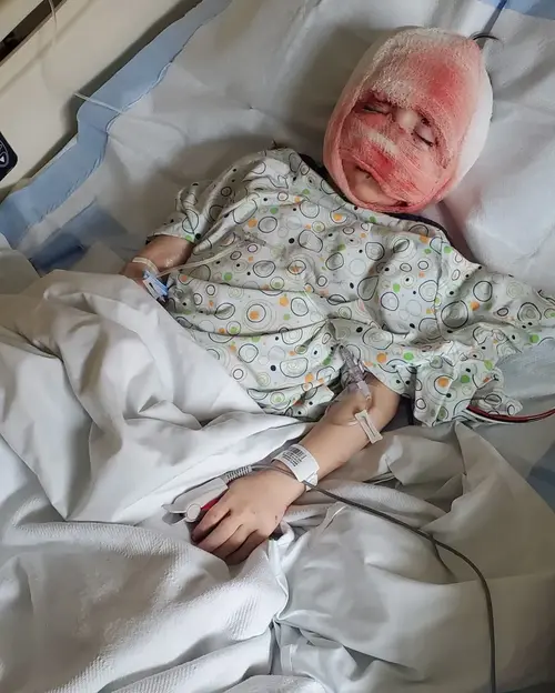 Bernardo - Criança que protegeu a irmã